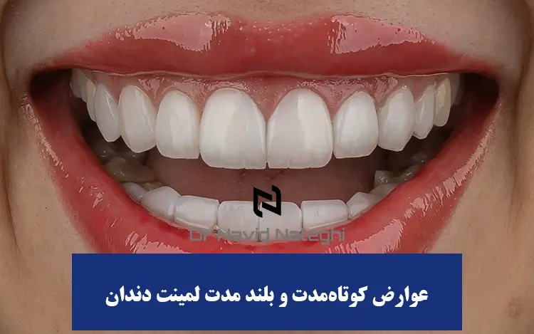 عوارض کوتاه‌مدت و شایع لمینت دندان