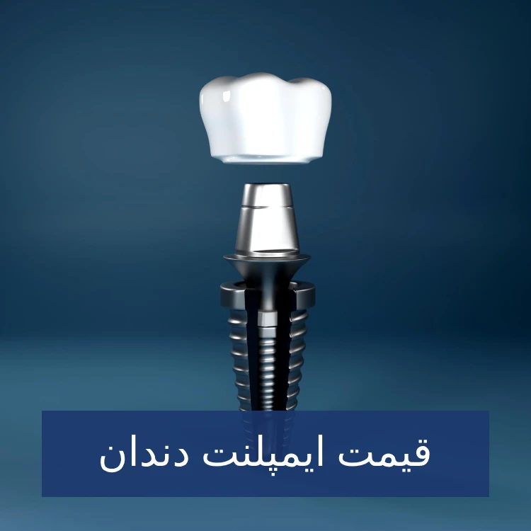 قیمت و هزینه ایمپلنت دندان