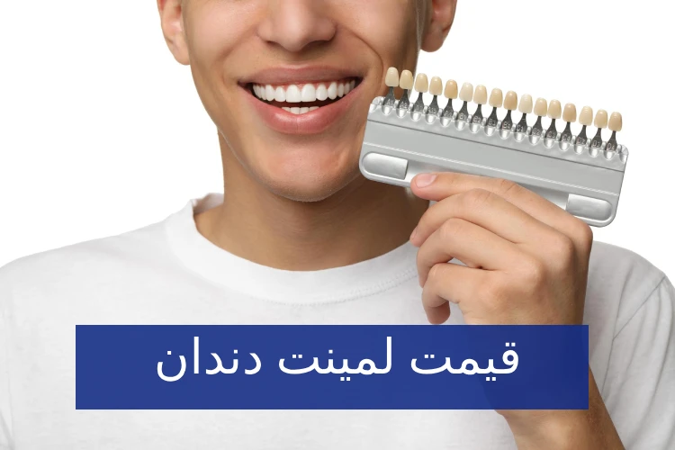 قیمت و هزینه لمینت دندان در تهران