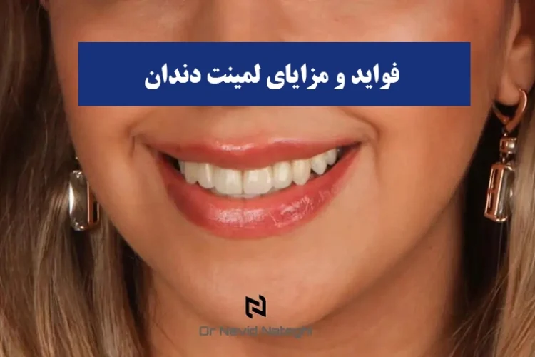 فواید و مزایای لمینت دندان که زندگی شما را متحول می‌کند!