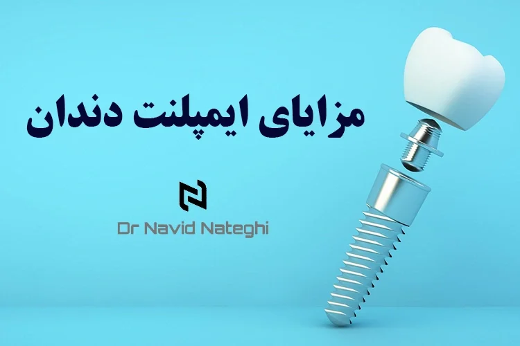 مزایای ایمپلنت دندان